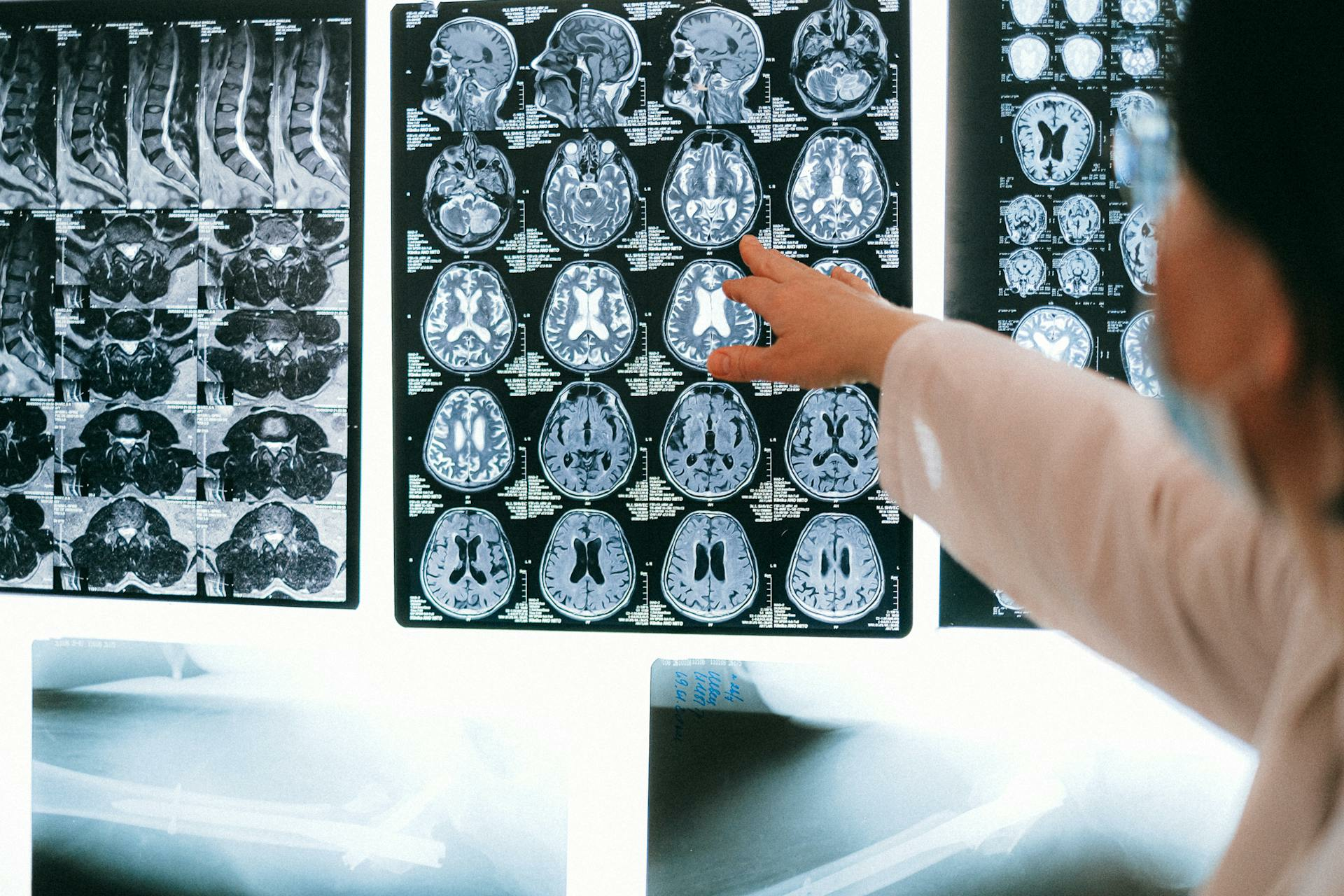 neurology