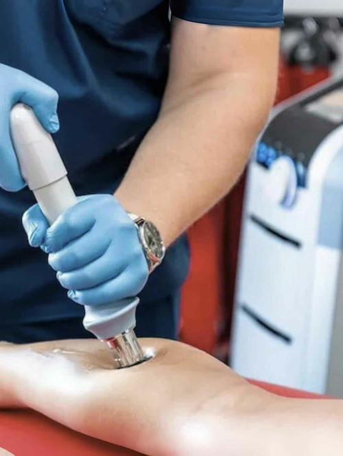 Ударно-волновая терапия